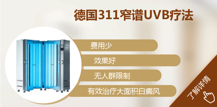 311窄谱UVB紫外线治疗